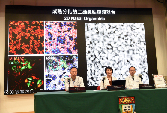 At the press conference (from right): Professor Kelvin To Kai-wang, Department Chairperson; Professor Jane Zhou Jie; and Dr Li Cun; all from the Department of Microbiology, School of Clinical Medicine, HKUMed. The HKUMed research team has successfully cultured HRV-C using their award-winning Human Respiratory Organoids, which previously earned a Gold Medal at the Geneva Exhibition of Inventions. Their work is advancing antiviral and vaccine research for this common cold virus.
 